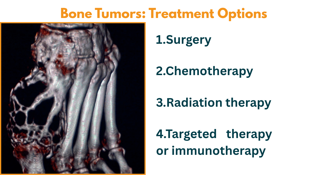 Bone tumor treatment options in Mumbai